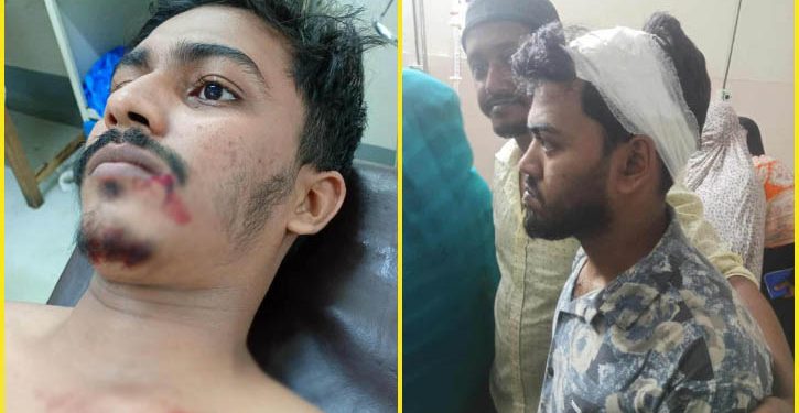 কনসার্টে ‘জয় বাংলা’ স্লোগান ঘিরে উত্তেজনা, পুলিশের গুলিতে আহত ৩