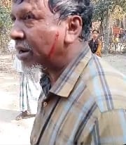 আনোয়ারায় গাছ কাটাকে কেন্দ্র করে ভাগিনার বিরুদ্ধে মামার উপর হামলা অভিযোগ 