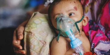 হামের প্রাদুর্ভাবের মধ্যেই শঙ্কা বাড়াচ্ছে নিউমোনিয়া