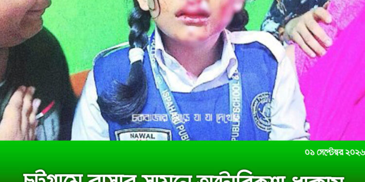 চট্টগ্রামে বাসার সামনে অটোরিকশার ধাক্কায় স্কুলছাত্রী আহত, বাবার ক্ষোভ